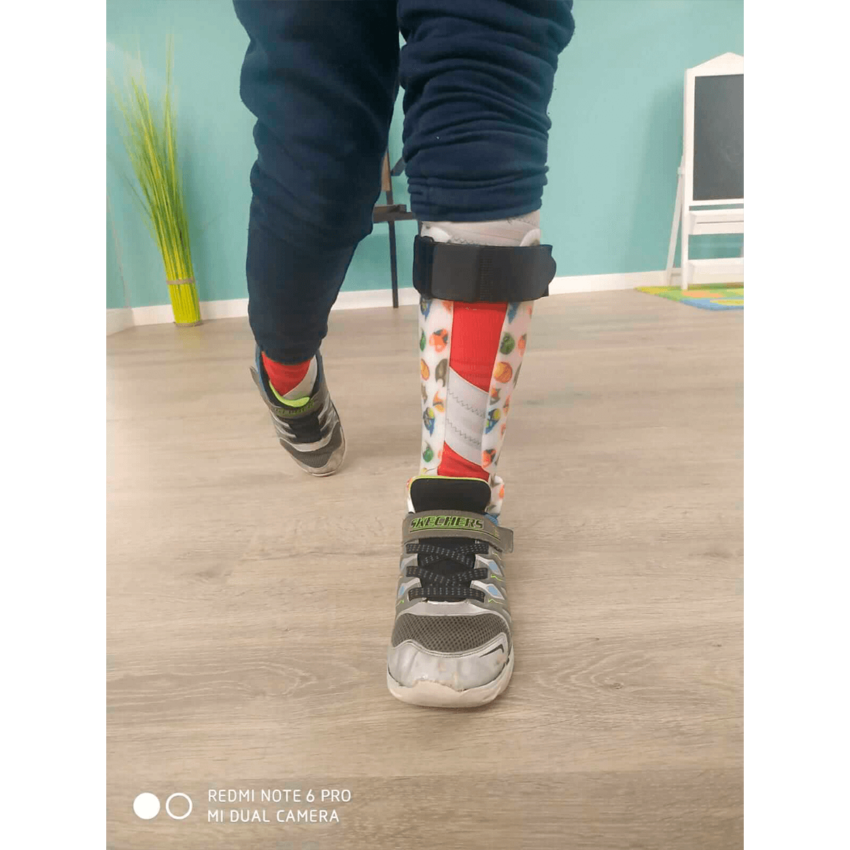 Órtesis con sistema dorsiflexor de tobillo 3